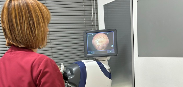 argi optika berea 2